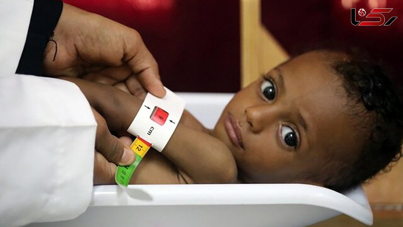 یونیسف: هر ۱۰ دقیقه یک کودک یمنی جان خود را از دست می دهد