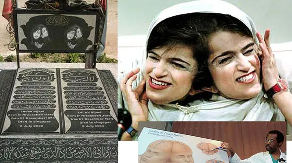  لاله و لادن فداکارترین دو قلوی جهان / به مناسبت سالروز مرگ دلخراش + عکس