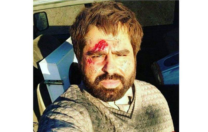 رکنا: برخی منابع در فضای مجازی خبر از زخمی شدن امیر نوری بازیگر جوان کشورمان در فلوجه عراق می دهند.