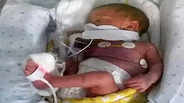 نوزاد زنده در قبرستان زاهدان رها شده بود+ عکس