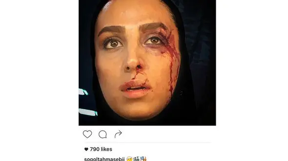 سوگل طهماسبی غرق در خون +عکس