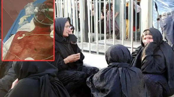 دهقان فداکار در آتش سوخت تا جنگل بلوط نسوزد+ فیلم و عکس