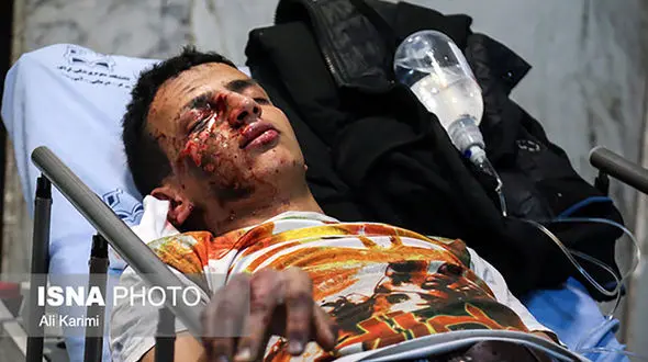 صحبت های جوانی که در چهارشنبه سوری همه چیزش را از دست داد + عکس