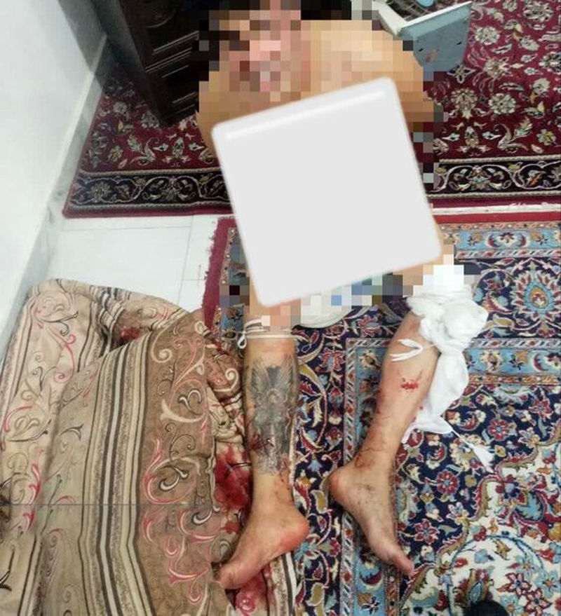 عامل تیراندازی در خیابان دیلمان شهرری با ضرب گلوله پلیس دستگیر شد