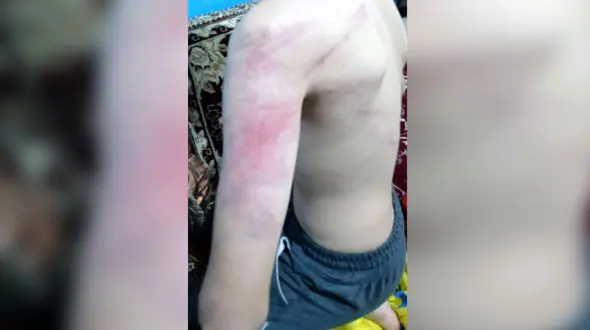 ضرب‌وشتم دانش‌آموزان با خشونت وحشیانه توسط معلم در سنندج + عکس های تکان‌دهنده و بیانیه آموزش و پرورش