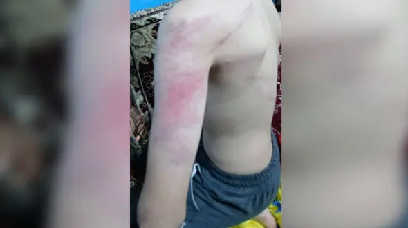 ضرب‌وشتم دانش‌آموزان با خشونت وحشیانه توسط معلم در سنندج + عکس های تکان‌دهنده و بیانیه آموزش و پرورش