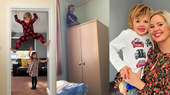 بیماری‌‌ای که این کودک را به مردعنکبوتی تبدیل کرد + تصاویر