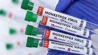 غربالگری ۱۱۸ نمونه مشکوک به آبله میمونی در کشور/ تجهیز ۱۲ مرکز آزمایشگاهی