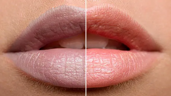 چطور تیرگی لب‌ها را از بین ببریم؟