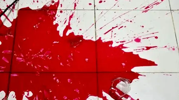 قتل پزشک طب سنتی در خانه اش بخاطر 10 هزار دلار 