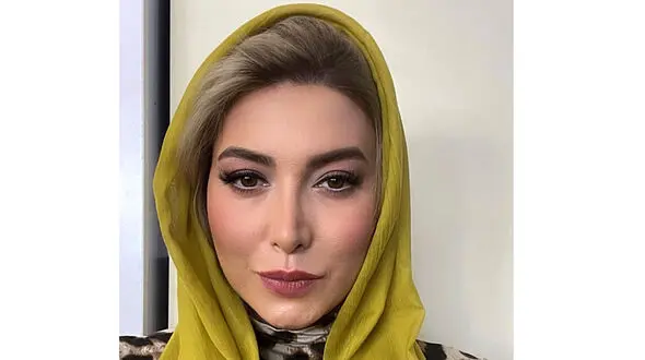  تغییر چهره باورنکردنی فریبا نادری قبل و بعد از عمل زیبایی!