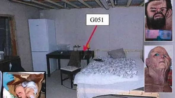 5 سال شکنجه شیطانی زن 30 ساله در اسارتگاه مخوف پزشک دیوانه + عکس