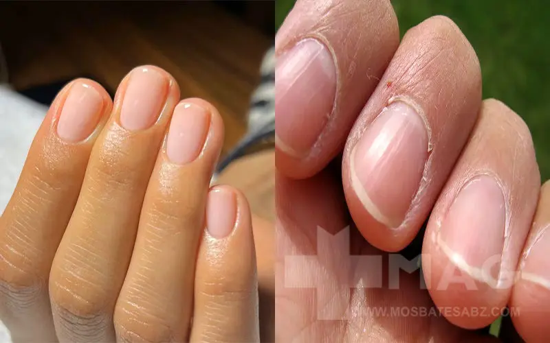 تصویر ناخن سالم