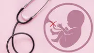 هشدار پزشکی قانونی درباره مهلت صدور مجوز سقط جنین؛ حداکثر زمان مجاز ۱۸ هفته است