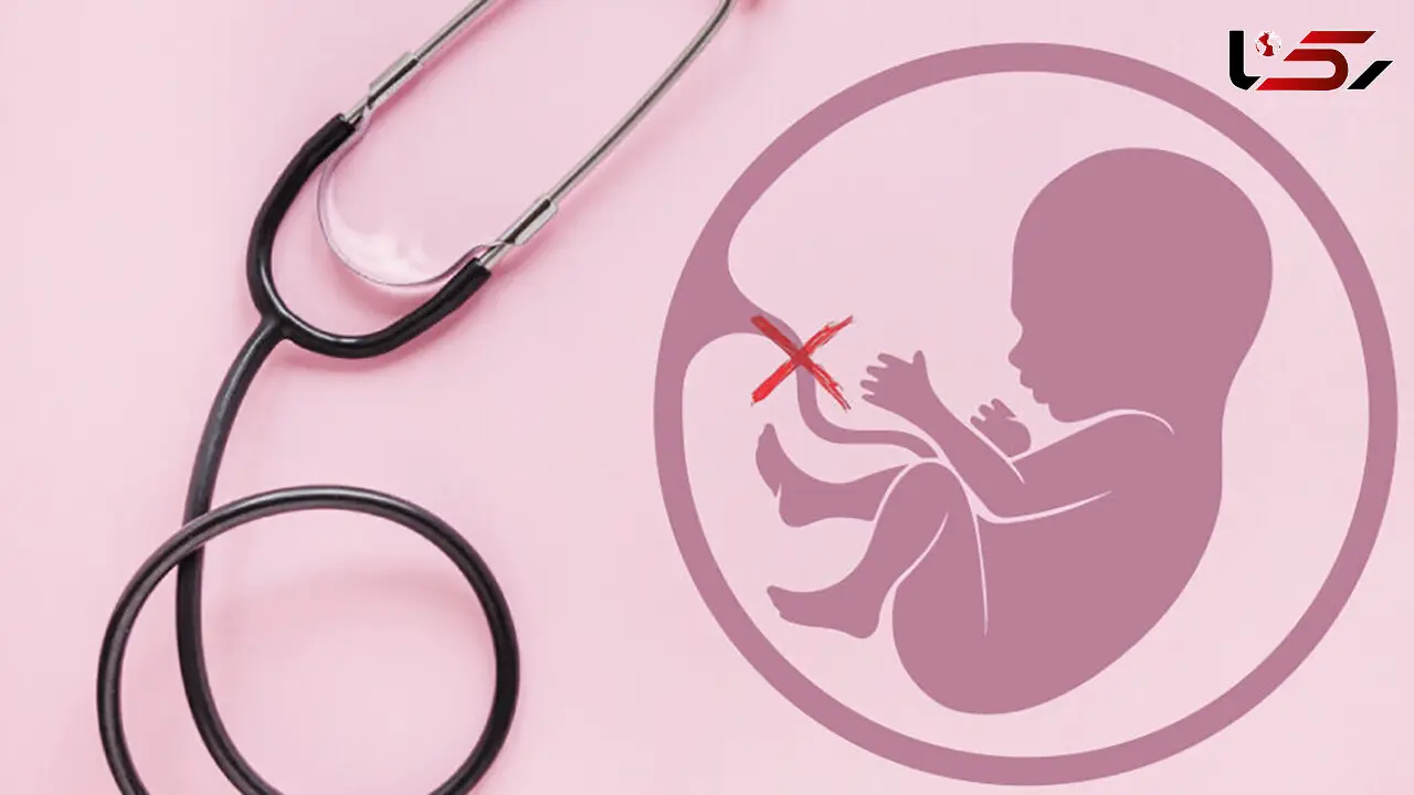 هشدار پزشکی قانونی درباره مهلت صدور مجوز سقط جنین؛ حداکثر زمان مجاز ۱۸ هفته است