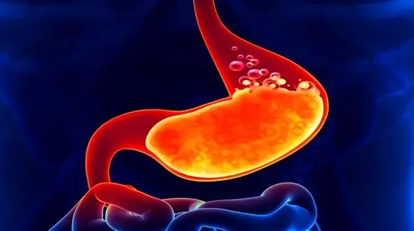 روش‌ های کاهش ترشح اسید معده + فیلم