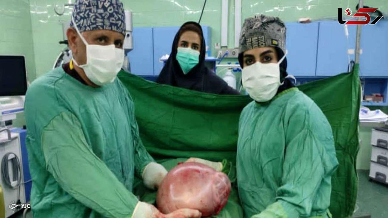 راز شکم برآمده زن شیرازی فاش شد / پزشکان شوکه شدند + عکس