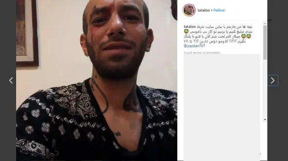 «امیر تتلو» همه پل های پشت سرش را خراب کرد؟