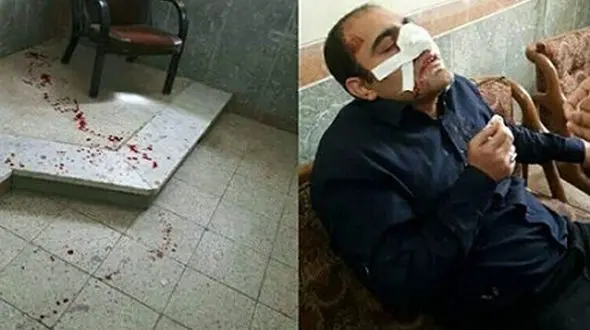 دستور وزیر آموزش و پرورش در پی کتک زدن ناجوانمردانه یک معلم در خوزستان + عکس 