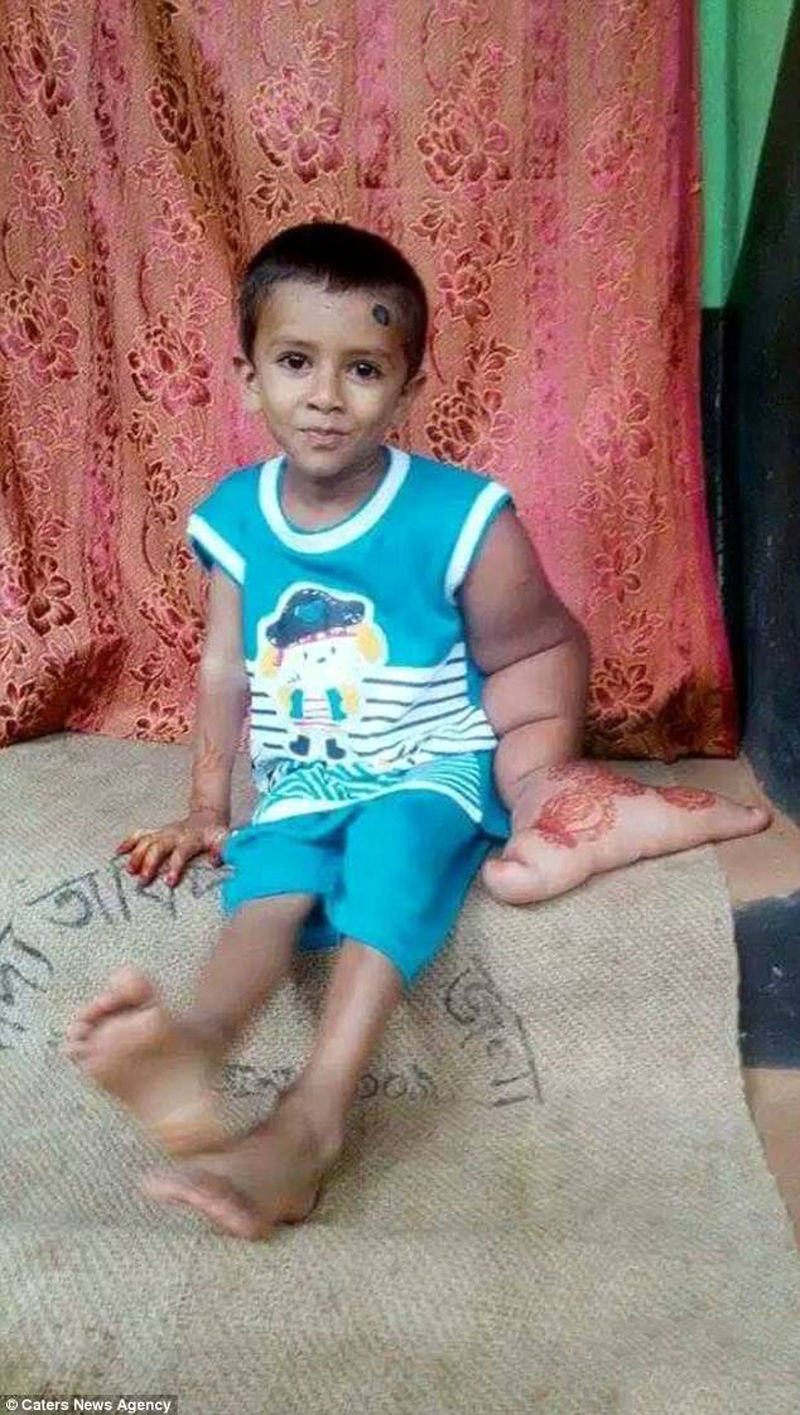 شیطان کوچک بنگلادش که مردم از او وحشت دارند 