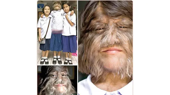 این دختر چطور تبدیل به گرگینه شد+ عکس