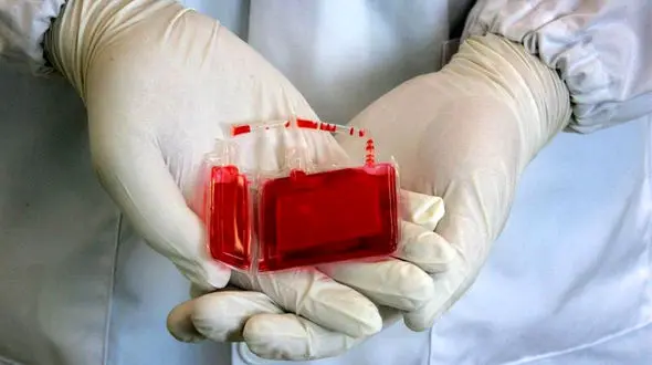 بیشترین استفاده بانک خون بندناف کجاست؟