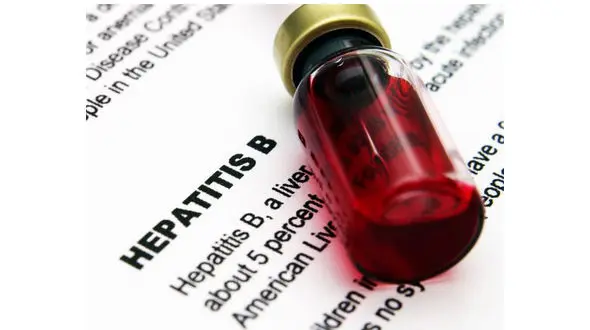قبل از هر چیز مراقب هپاتیت باشید