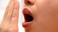 دلیل اصلی بوی بد دهان چیست؟