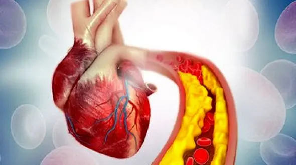 با مصرف این ماده غذایی، کلسترول خونتان را تنظیم کنید