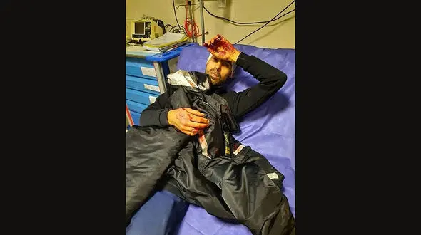 جزئیات حمله خونین به ماموران گشت شهرداری در منطقه کوهسار تهران + عکس