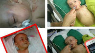 جزئیات بیشتر از شکنجه یک نوزاد در رشت+عکس
