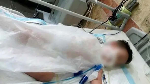 کودک 2 ساله با اسید سوخت+عکس