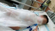 کودک 2 ساله با اسید سوخت+عکس