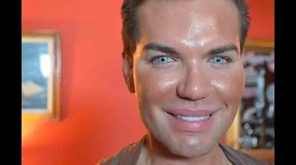 عطش بی پایان مرد عروسکی برای زیباتر شدن / این مرد رکورد دار جراحی پلاستیک در دنیاست! +عکس