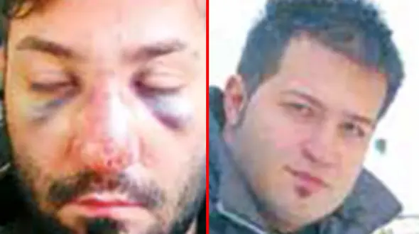 جزئیات مرگ مبهم پسر جوان در کلانتری 127 نارمک+عکس قبل و بعد از دستگیری