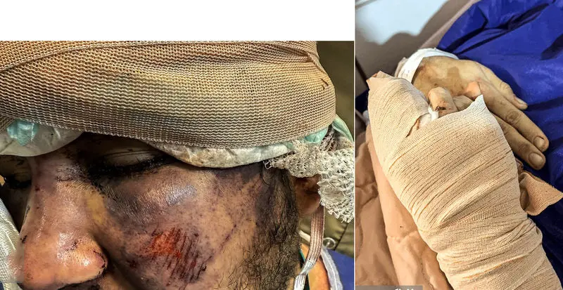 تصاویر دردناک