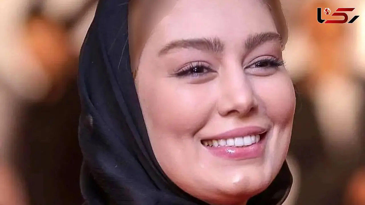 تغییر چهره فاحش سحر قریشی قبل از بازیگر شدن ! / این اون نیست ؟! + عکس حیرت آور