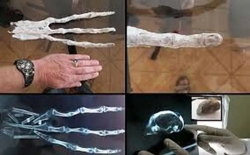 تغییر شکل انگشتان دست انسان