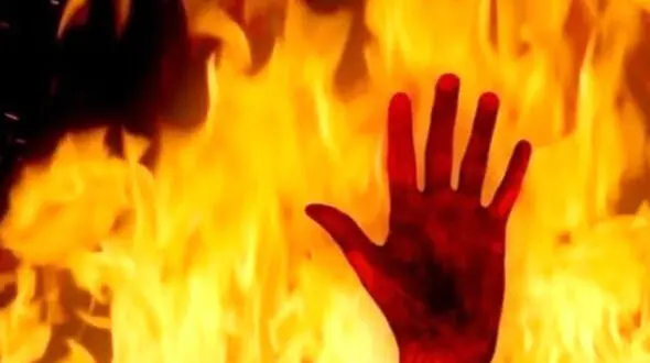 سوختن 2 کارگر در کارخانه رینگ اسپرت / در نی ریز رخ داد