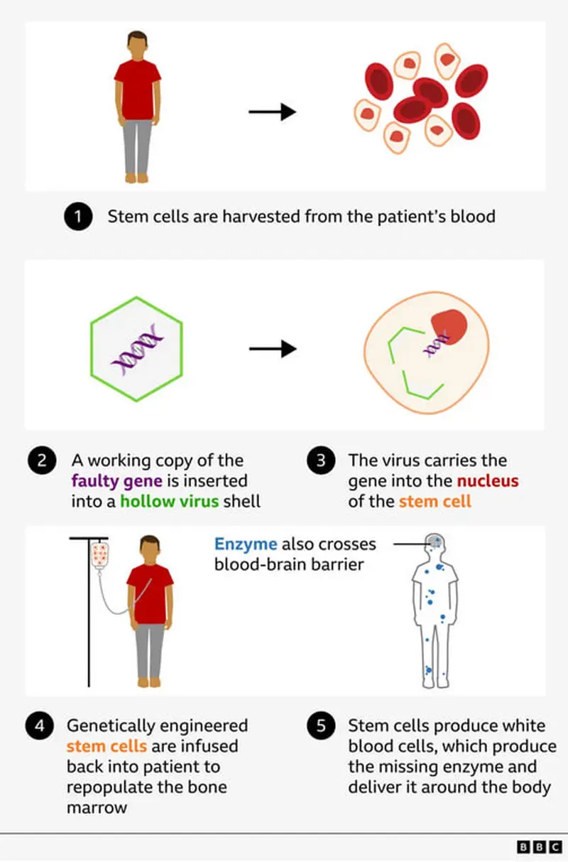 Boy with rare condition6