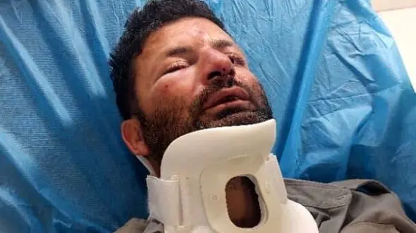 ضرب و شتم شدید یک محیط‌بان در شمیرانات