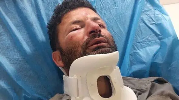 ضرب و شتم شدید یک محیط‌بان در شمیرانات