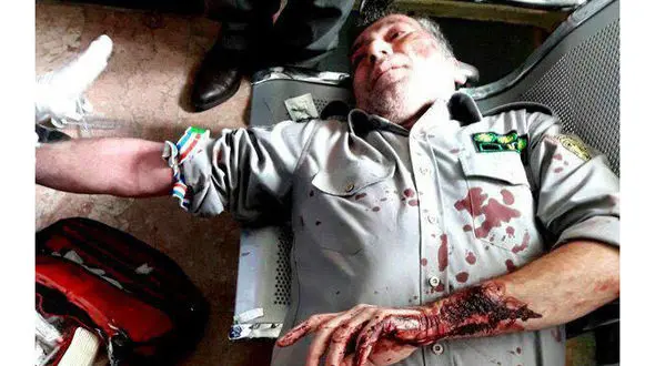 حمله وحشیانه با تبر به محیط بان وظیفه شناس در سفیدکوه لرستان! + عکس