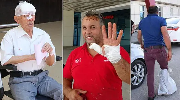 زخمی شدن 5 هزار قصاب در مراسم عید قربان در ترکیه + عکس 