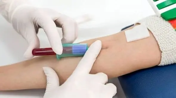 در انجام کدام آزمایش ها باید ناشتا باشیم ؟ + اینفوگرافی