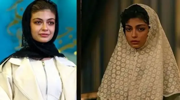 فیلم / تغییر چهره ستایش دهقان بازیگر سریال شکارگاه در 17 سالگی با تزریق ژل / زود دست به کار شد