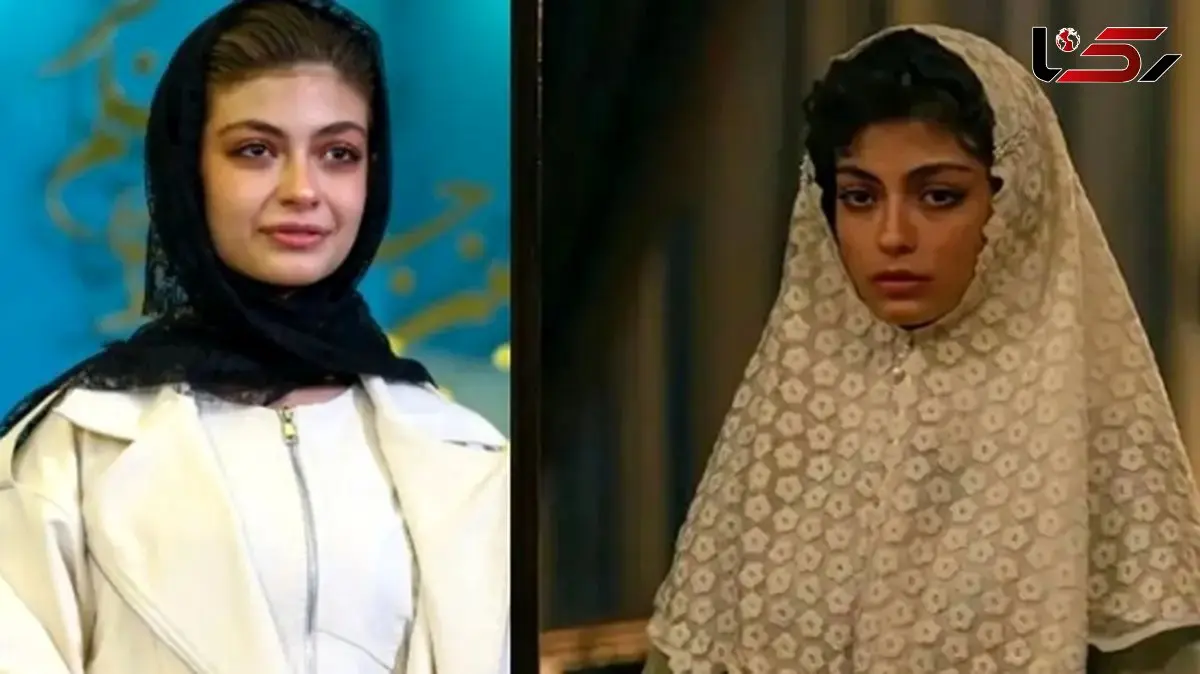 فیلم / تغییر چهره ستایش دهقان بازیگر سریال شکارگاه در 17 سالگی با تزریق ژل / زود دست به کار شد