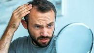 درمان نازکی موی سر با 8 ترفند طبیعی و موثر