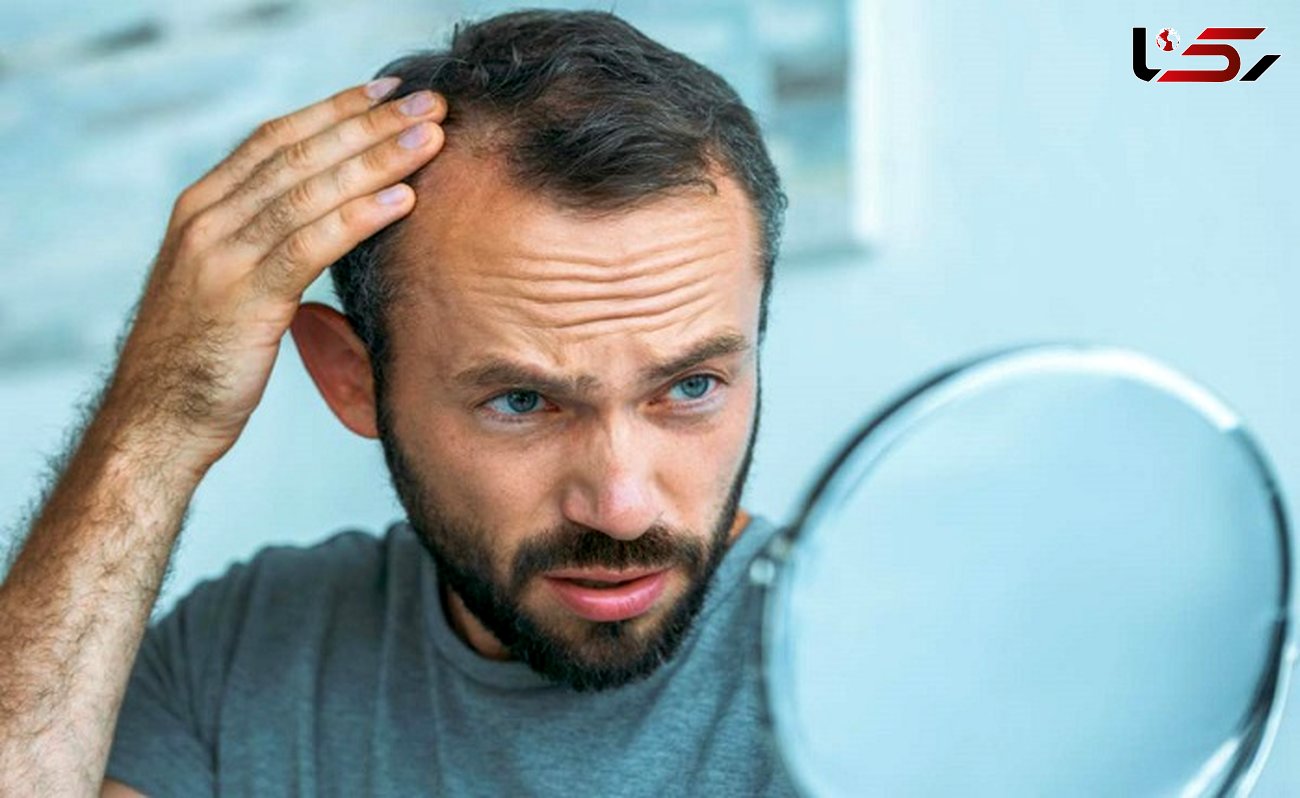 درمان نازکی موی سر با 8 ترفند طبیعی و موثر