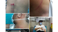 کتک خوردن کارشناسان اورژانس قزوین / بستری مصدومان در بیمارستان + عکس